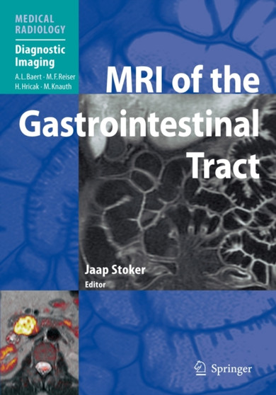 MRI of the Gastrointestinal Tract by Jaap Stoker - Paperback