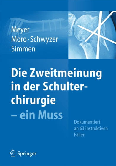 Die Zweitmeinung in der Schulterchirurgie - ein Muss by Rainer Peter Meyer - Hardback
