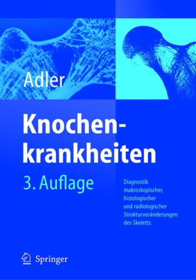 Knochenkrankheiten : Diagnostik Makroskopischer, Histologischer Und Radiologischer Strukturveranderungen Des Skeletts by Claus-Peter MD Adler - Hardback