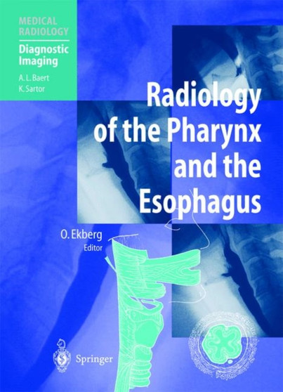 Radiology of the Pharynx and the Esophagus by O. Ekberg - Hardback