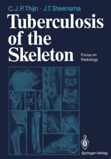 Tuberculosis of the Skeleton : Focus on Radiology by C.J.P. Thijn - Hardback