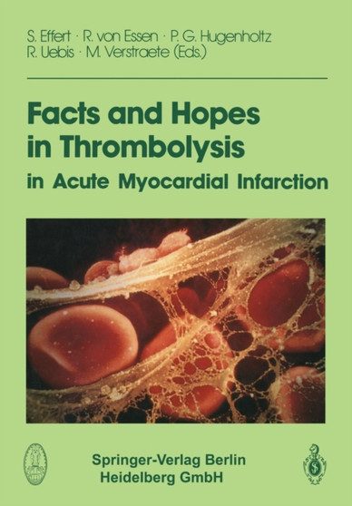 Facts and Hopes in Thrombolysis in Acute Myocardial Infarction by S. Effert - Paperback