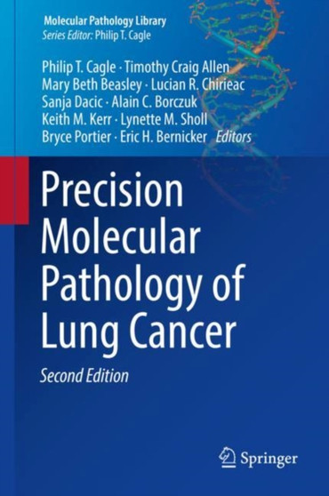 Precision Molecular Pathology of Lung Cancer by Philip T. Cagle - Hardback