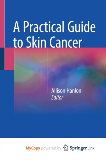 A Practical Guide to Skin Cancer by Hanlon Allison Hanlon - Paperback