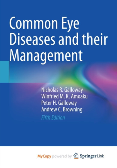 Common Eye Diseases and their Management by Galloway Nicholas R. Galloway - Paperback