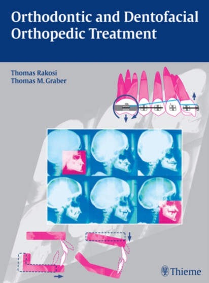 Orthodontic and Dentofacial Orthopedic Treatment by Thomas Rakosi - Hardback