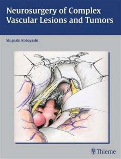 Neurosurgery of Complex Vascular Lesions and Tumors by Shigeaki Kobayashi - Hardback
