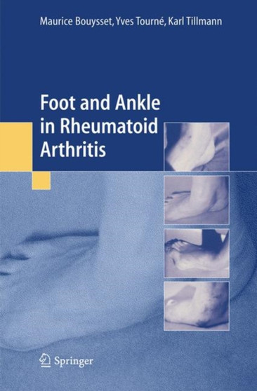 Foot and Ankle in Rheumatoid Arthritis by M. Bouysset - Paperback