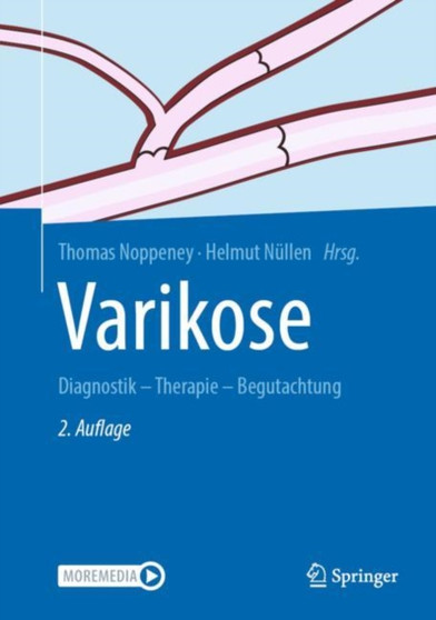 Varikose : Diagnostik - Therapie - Begutachtung by Thomas Noppeney - Hardback