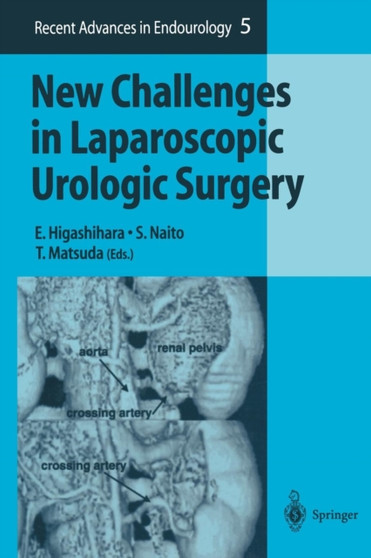 New Challenges in Laparoscopic Urologic Surgery : 5 by E. Higashihara - Paperback