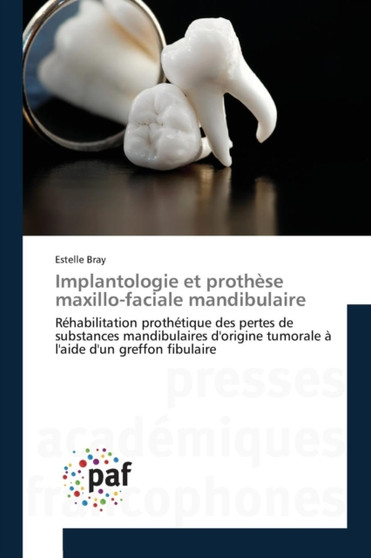 Implantologie Et Prothese Maxillo-Faciale Mandibulaire by Bray-E - Paperback
