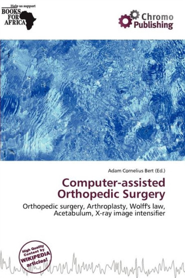 Computer-Assisted Orthopedic Surgery by Adam Cornelius Bert - Paperback