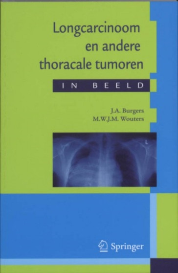 Longcarcinoom En Andere Thoracale Tumoren in Beeld : Casuistiek in Een Breder Perspectief by J A Burgers - Paperback