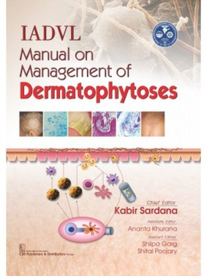IADVL Manual on Management of Dermatophytoses by Kabir Sardana - Hardback