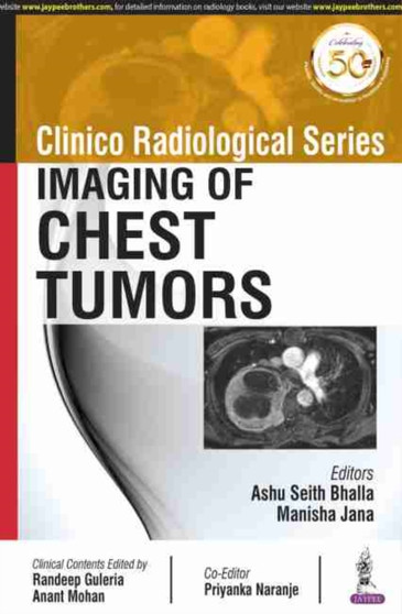 Clinico Radiological Series: Imaging of Chest Tumors by Ashu Seith Bhalla - Paperback