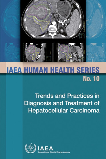 Trends and Practices in Diagnosis and Treatment of Hepatocellular Carcinoma by IAEA - Paperback