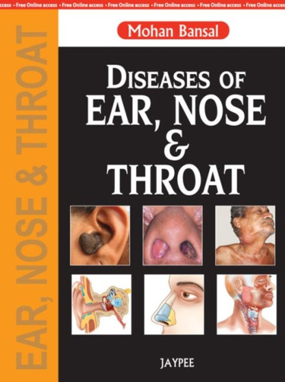 Diseases of Ear, Nose and Throat by Mohan Bansal - Paperback