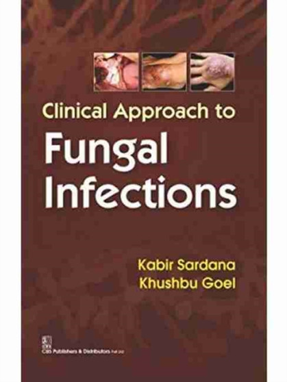 Clinical Approach to Fungal Infections by Sardana Kabir - Paperback