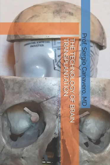 The Technology of Brain Transplantation by Sergio Canavero - Paperback