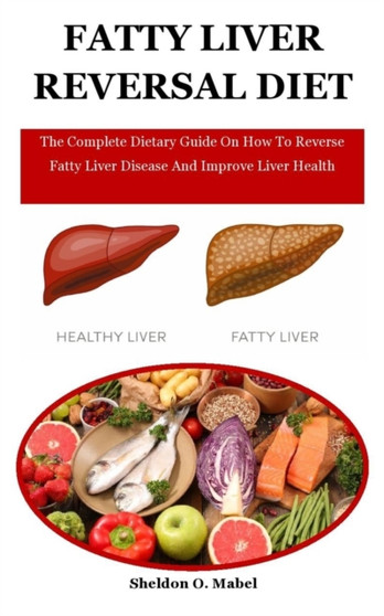 Fatty Liver Reversal Diet : The Complete Dietary Guide On How To Reverse Fatty Liver Disease And Improve Liver Health by Sheldon O Mabel - Paperback