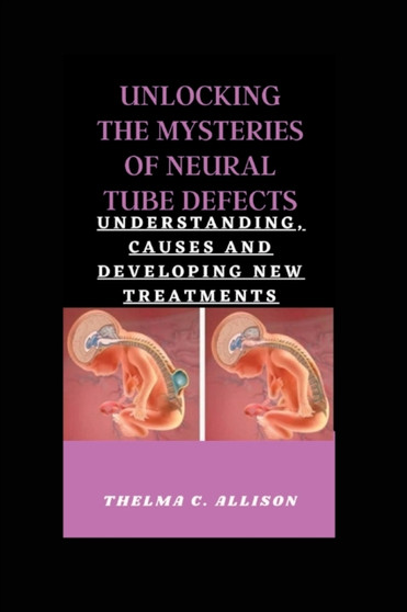 Unlocking the Mysteries of Neural Tube Defects : Understanding, Causes and Developing New Treatments by Thelma C Allison - Paperback
