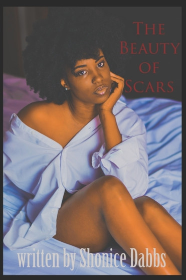 The Beauty of Scars by Shonice Dabbs - Paperback