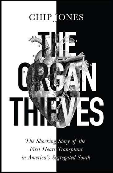 The Organ Thieves by Chip Jones - Paperback