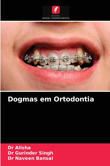 Dogmas em Ortodontia by Dr Alisha - Paperback