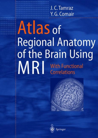 Atlas of Regional Anatomy of the Brain Using Mri : With Clinical and Functional Correlations