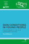 Skin conditions in young people : A practical guide on how to be comfortable in your skin