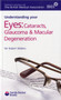 Understanding Eyes : Cataracts, Glaucoma & Macular Degeneration