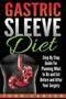 Gastric Sleeve Diet : Step By Step Guide For Planning What to Do and Eat Before and After Your Surgery