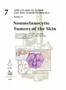Nonmelanocytic Tumors of the Skin by Thomas Brenn - Hardback