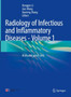 Radiology of Infectious and Inflammatory Diseases - Volume 1 : Brain and Spinal Cord by Hongjun Li - Hardback