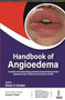 Handbook of Angioedema by Kiran V Godse - Paperback