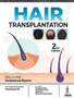 Hair Transplantation by Venkataram Mysore - Hardback