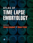 Atlas of Time Lapse Embryology by Alison Campbell - Paperback