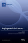 Angiogenesis in Cancers by Domenico Ribatti - Hardback