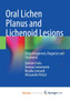 Oral Lichen Planus and Lichenoid Lesions : Etiopathogenesis, Diagnosis and Treatment by Isola Gaetano Isola - Paperback