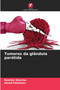Tumores da glandula parotida by Reshmi Sharma - Paperback