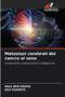 Metastasi cerebrali del cancro al seno by Wala Ben Kridis - Paperback