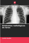 Sindromes radiologicos do torax by Lynda Aoudia - Paperback