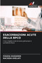 Esacerbazioni Acute Della Bpco by Fouzia Oussedik - Paperback