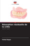 Resorption residuelle de la crete by Vishal Dogra - Paperback