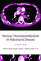 Venous Thromboembolism in Advanced Disease : A clinical guide by Simon I R Noble - Paperback