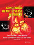 Congenital Heart Disease in Adults by Jana Popelova - Paperback