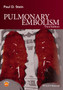 Pulmonary Embolism by Paul D. Stein - Hardback