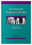 Developmental Dysplasia of the Hip by J.Richard Bowen - Paperback