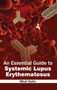 Essential Guide to Systemic Lupus Erythematosus by Mitch Sellin - Hardback Essential Guide to Systemic Lupus Erythematosus by Mitch Sellin - Hardback