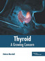 Thyroid: A Growing Concern by Dakota Marshall - Hardback